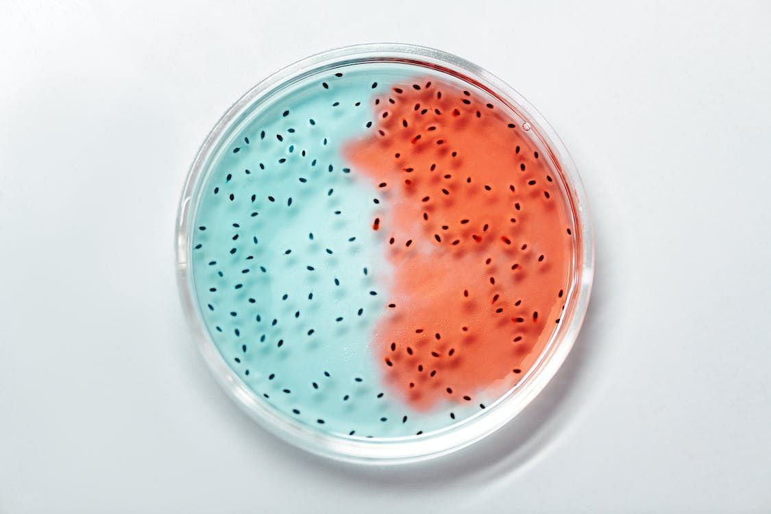 Gaining insight into these associations can provide valuable information for developing targeted interventions and management strategies aimed at alleviating the burden of food allergies within affected populations. (Edward Jenner/ Pexels)
